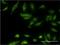 Choline Kinase Beta antibody, H00055500-M09, Novus Biologicals, Immunocytochemistry image 