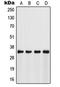 Fibrinogen Silencer Binding Protein antibody, orb215431, Biorbyt, Western Blot image 