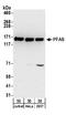 Phosphoribosylformylglycinamidine Synthase antibody, A304-220A, Bethyl Labs, Western Blot image 