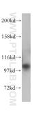 Inositol polyphosphate 5-phosphatase OCRL-1 antibody, 17695-1-AP, Proteintech Group, Western Blot image 