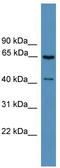 GRK1 antibody, TA342734, Origene, Western Blot image 