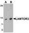 Late Endosomal/Lysosomal Adaptor, MAPK And MTOR Activator 3 antibody, PA5-72801, Invitrogen Antibodies, Western Blot image 