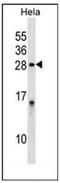 Protein phosphatase inhibitor 2 antibody, AP53416PU-N, Origene, Western Blot image 