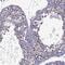 Zinc Finger Protein 646 antibody, NBP2-68841, Novus Biologicals, Immunocytochemistry image 