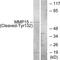 Matrix Metallopeptidase 15 antibody, TA314207, Origene, Western Blot image 