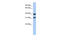 SET Domain Containing 9 antibody, 26-757, ProSci, Western Blot image 