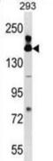 FA Complementation Group A antibody, abx029937, Abbexa, Western Blot image 