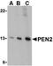 Presenilin Enhancer, Gamma-Secretase Subunit antibody, LS-C19652, Lifespan Biosciences, Western Blot image 