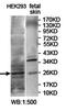 RAB27A, Member RAS Oncogene Family antibody, orb78151, Biorbyt, Western Blot image 