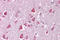 Calcium Voltage-Gated Channel Subunit Alpha1 G antibody, ARP35566_P050, Aviva Systems Biology, Immunohistochemistry frozen image 