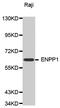 Ectonucleotide Pyrophosphatase/Phosphodiesterase 1 antibody, MBS125058, MyBioSource, Western Blot image 