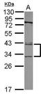 XPA, DNA Damage Recognition And Repair Factor antibody, PA5-27852, Invitrogen Antibodies, Western Blot image 