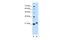Chromosome 1 Open Reading Frame 159 antibody, 30-280, ProSci, Western Blot image 