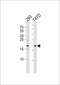 Microtubule-associated proteins 1A/1B light chain 3C antibody, LS-C165708, Lifespan Biosciences, Western Blot image 