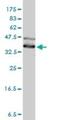 DnaJ Heat Shock Protein Family (Hsp40) Member A4 antibody, H00055466-M01, Novus Biologicals, Western Blot image 