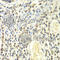 Proteasome Subunit Alpha 4 antibody, A2511, ABclonal Technology, Immunohistochemistry paraffin image 