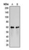 Colony Stimulating Factor 2 Receptor Alpha Subunit antibody, orb393258, Biorbyt, Western Blot image 