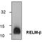 Resistin Like Beta antibody, TA319114, Origene, Western Blot image 