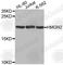 High Mobility Group Nucleosomal Binding Domain 2 antibody, A2262, ABclonal Technology, Western Blot image 