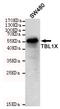 Transducin Beta Like 1 X-Linked antibody, M07014, Boster Biological Technology, Western Blot image 