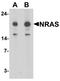 Ras antibody, LS-B10113, Lifespan Biosciences, Western Blot image 