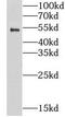 Lysophosphatidylcholine Acyltransferase 2 antibody, FNab04827, FineTest, Western Blot image 
