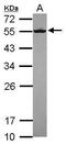Septin 8 antibody, PA5-31356, Invitrogen Antibodies, Western Blot image 