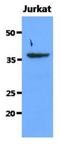Sorbitol Dehydrogenase antibody, NBP2-42653, Novus Biologicals, Western Blot image 