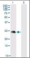 TSC22 Domain Family Member 3 antibody, orb89582, Biorbyt, Western Blot image 