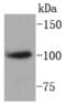 SATB Homeobox 1 antibody, NBP2-67371, Novus Biologicals, Western Blot image 