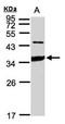 Natural Cytotoxicity Triggering Receptor 3 antibody, orb13335, Biorbyt, Western Blot image 