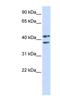Zinc Finger RANBP2-Type Containing 2 antibody, NBP1-57524, Novus Biologicals, Western Blot image 