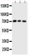 Cell Division Cycle 25A antibody, PA1545, Boster Biological Technology, Western Blot image 