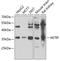 AKT Interacting Protein antibody, A08184, Boster Biological Technology, Western Blot image 