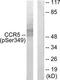 C-C Motif Chemokine Receptor 5 (Gene/Pseudogene) antibody, TA313323, Origene, Western Blot image 