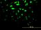 Dual Specificity Phosphatase 5 antibody, H00001847-M03, Novus Biologicals, Immunofluorescence image 