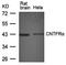 Ciliary neurotrophic factor receptor subunit alpha antibody, orb69614, Biorbyt, Western Blot image 