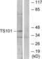 Tumor Susceptibility 101 antibody, LS-C199692, Lifespan Biosciences, Western Blot image 