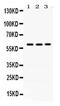 V(D)J recombination-activating protein 2 antibody, PA5-79909, Invitrogen Antibodies, Western Blot image 
