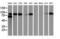 Catenin Beta 1 antibody, LS-C172670, Lifespan Biosciences, Western Blot image 