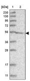 F-Box And Leucine Rich Repeat Protein 4 antibody, PA5-56072, Invitrogen Antibodies, Western Blot image 