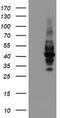 Leucine Rich Repeat Containing 25 antibody, TA504883, Origene, Western Blot image 