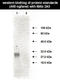 TIMP Metallopeptidase Inhibitor 1 antibody, TA353510L, Origene, Western Blot image 