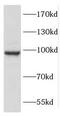 Coatomer Protein Complex Subunit Gamma 2 antibody, FNab01867, FineTest, Western Blot image 