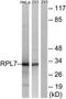 Ribosomal Protein L5 antibody, TA314454, Origene, Western Blot image 