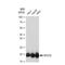 Mitochondrially Encoded Cytochrome C Oxidase II antibody, GTX03205, GeneTex, Western Blot image 