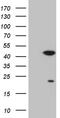 Cyclin-dependent kinase 20 antibody, TA809548, Origene, Western Blot image 