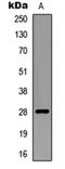 E3 ubiquitin-protein ligase RNF138 antibody, orb304556, Biorbyt, Western Blot image 