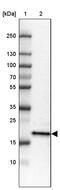 Zinc Finger Protein 22 antibody, PA5-53481, Invitrogen Antibodies, Western Blot image 