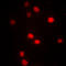 DNA Methyltransferase 3 Beta antibody, LS-C352124, Lifespan Biosciences, Immunofluorescence image 